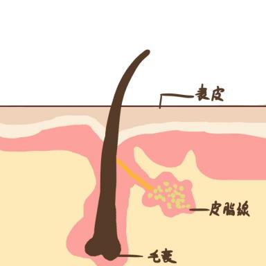 甲硝唑凝膠是抗生素嗎?