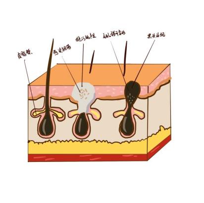 帶你了解黑頭毛孔粗大怎么解決？