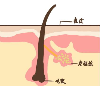 去黑頭粉刺的有效方法是什么？