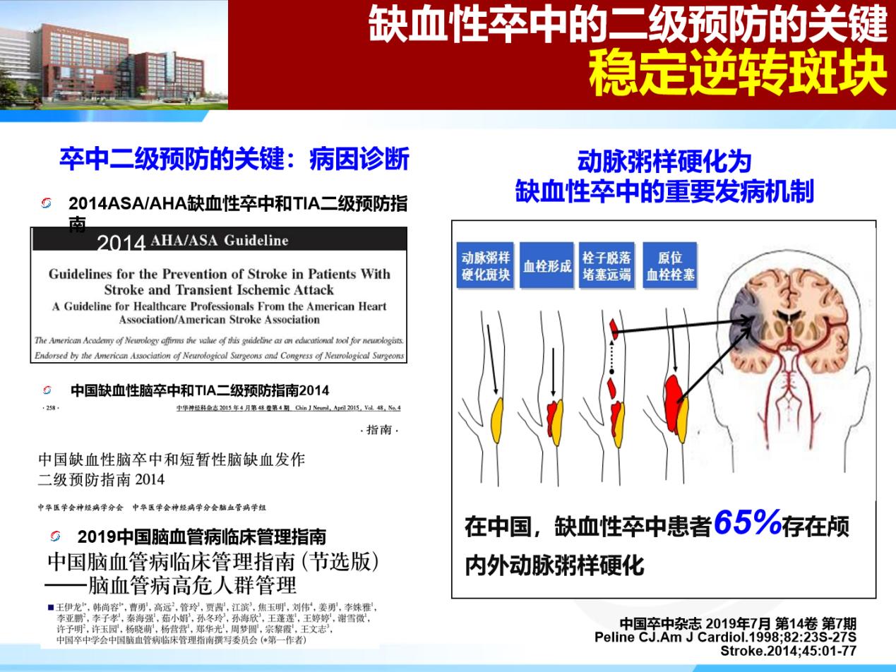 干預(yù)動(dòng)脈粥樣硬化進(jìn)展，做好卒中的二級(jí)預(yù)防