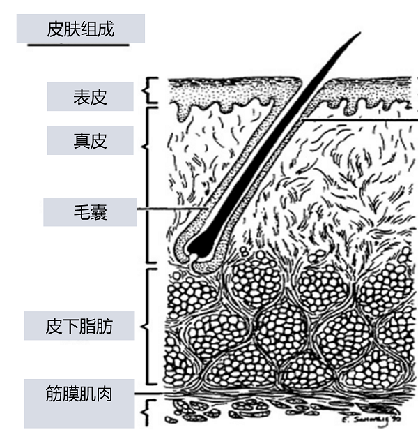 毛囊炎毛孔堵塞祛痘的藥物有哪些？可以這樣選