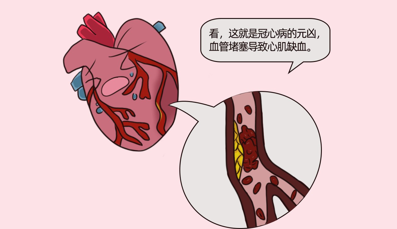 冠心病是由什么原因引起的？如何治療冠心病